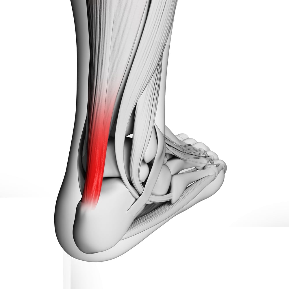 Tendonitis • Family Foot & Ankle Clinic